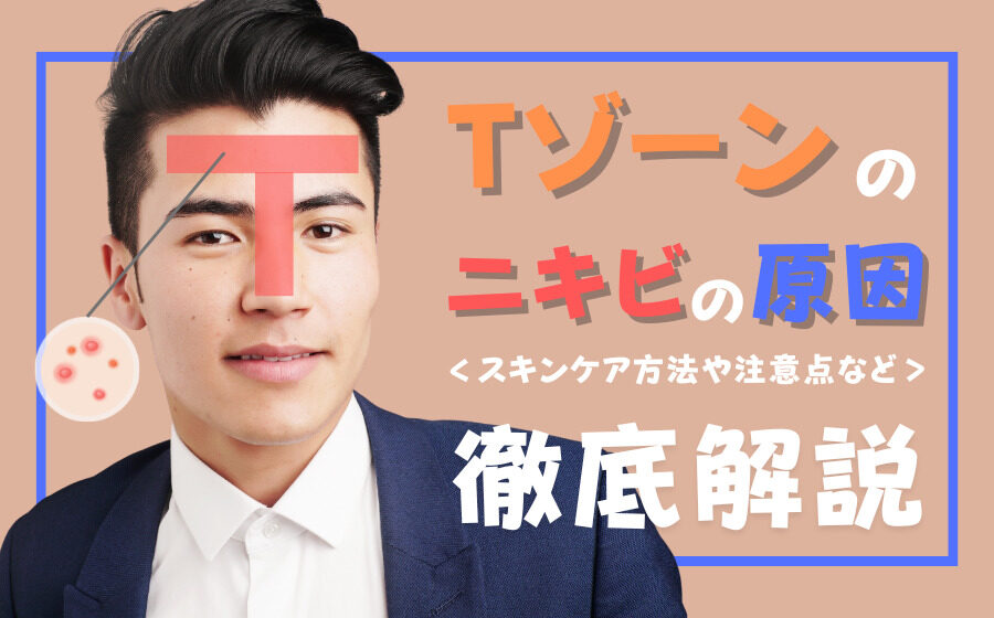 Tゾーンのニキビの原因とは？スキンケア方法や注意点などを解説