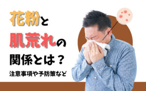 花粉と肌荒れの関係とは？3つの注意事項や予防策などを徹底解説