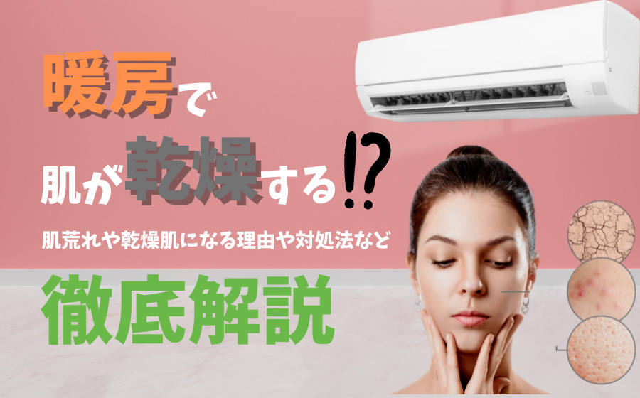 暖房は肌が乾燥する原因に！肌荒れや乾燥肌になる理由や対処法を解説